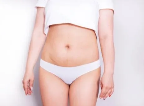 Lower Body Surgery performed by Dr. Antoine Abi Abboud, plastic surgeon in Beirut, Lebanon