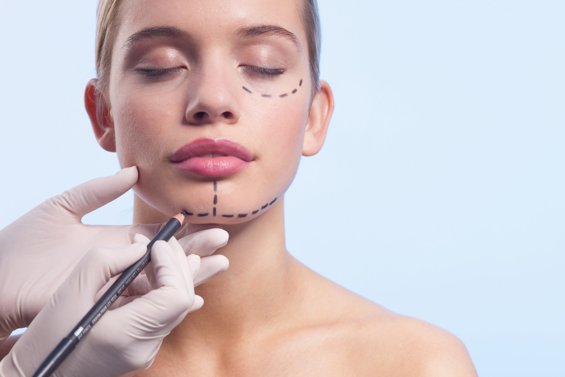 Facial aesthetic procedure planning by Dr. Antoine Abi Abboud